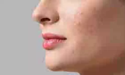 Skin Care: चेहरे के जिद्दी दाग-धब्बे हो जाएंगे दूर, लगाएं औषधीय गुणों से भरपूर ये पेस्ट Skin Care: चेहरे के जिद्दी दाग-धब्बे हो जाएंगे दूर, लगाएं औषधीय गुणों से भरपूर ये पेस्ट