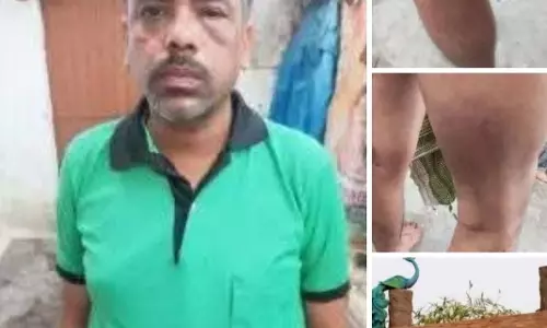 अधिकारी ने कर्मचारी को पुलिस से पिटवाया, आंख हाथ और पैर में सूजन अधिकारी ने कर्मचारी को पुलिस से पिटवाया, आंख हाथ और पैर में सूजन