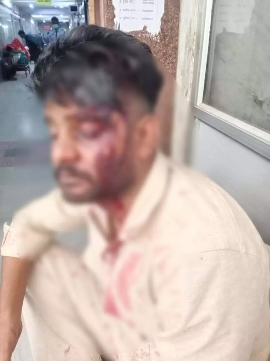उर्स के दौरान युवक पर जानलेवा हमला, बेसबॉल स्टिक और लोहे की रॉड से की गई पिटाई उर्स के दौरान युवक पर जानलेवा हमला, बेसबॉल स्टिक और लोहे की रॉड से की गई पिटाई
