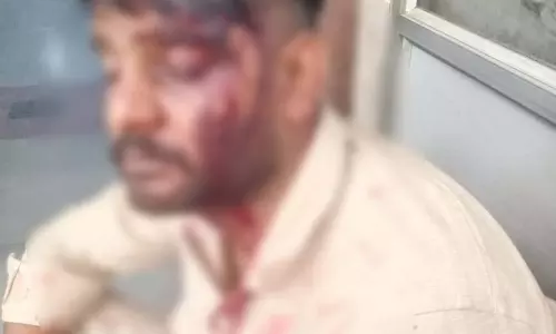 उर्स के दौरान युवक पर जानलेवा हमला, बेसबॉल स्टिक और लोहे की रॉड से की गई पिटाई