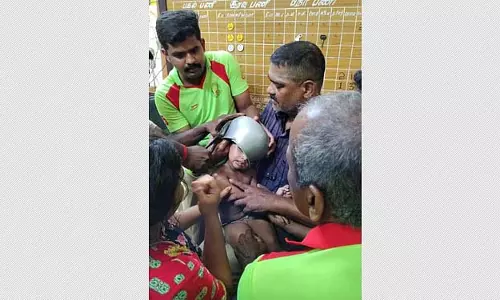 Tamil Nadu : चेन्नई में ढाई साल के बच्चे के सिर में पॉट फंस गया Tamil Nadu : चेन्नई में ढाई साल के बच्चे के सिर में पॉट फंस गया
