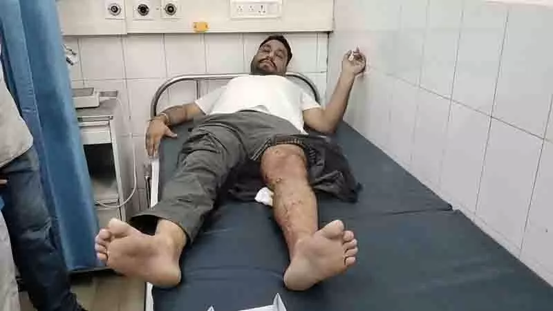 संपत्ति विवाद को लेकर NRI ने फिल्लौर में सामाजिक कार्यकर्ता के सहयोगी पर गोली चलाई संपत्ति विवाद को लेकर NRI ने फिल्लौर में सामाजिक कार्यकर्ता के सहयोगी पर गोली चलाई