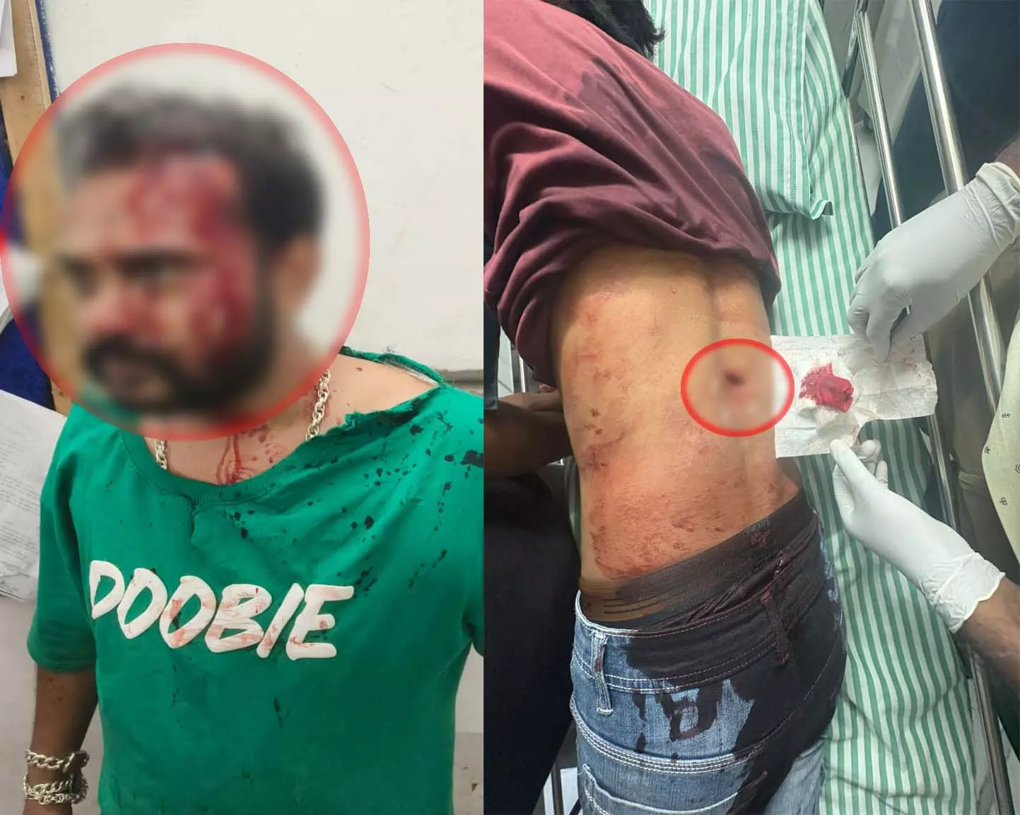 रायपुर में फिर चली चाकू और रॉड, ईदगाहभाठा में विवाद के बाद हमला, चार युवक गंभीर रायपुर में फिर चली चाकू और रॉड, ईदगाहभाठा में विवाद के बाद हमला, चार युवक गंभीर