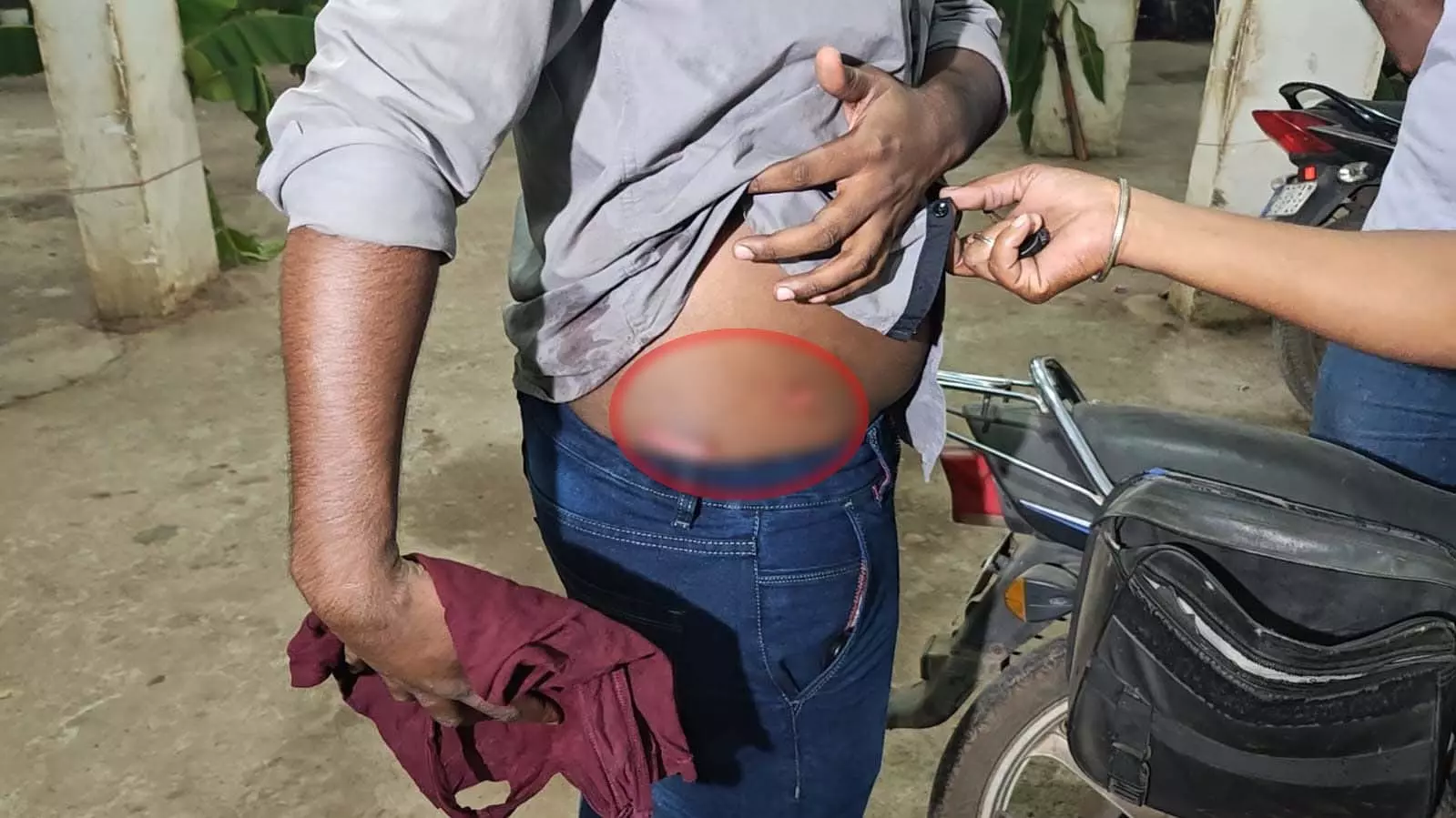 Raipur: दिवाली में चाकूबाजी की दूसरी घटना, राजेंद्र नगर में युवक घायल Raipur: दिवाली में चाकूबाजी की दूसरी घटना, राजेंद्र नगर में युवक घायल