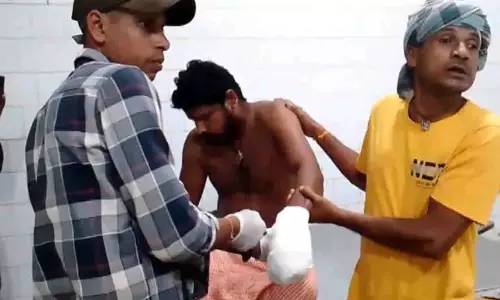 पटाखे जलाते समय बड़ा हादसा, युवक का हाथ गंभीर रूप से घायल