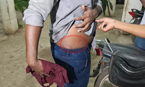 Raipur: दिवाली में चाकूबाजी की दूसरी घटना, राजेंद्र नगर में युवक घायल