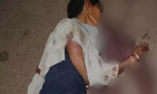 कॉलेज के सामने रोड में मिली लाश, अज्ञात वाहन की चपेट में आने की आशंका