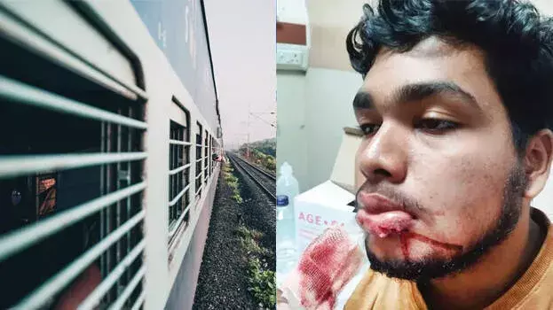 Kerala : चेहरे पर लगी चोट के बाद RPF ने कोझिकोड प्लेटफ़ॉर्म घटना की पेश की रिपोर्ट