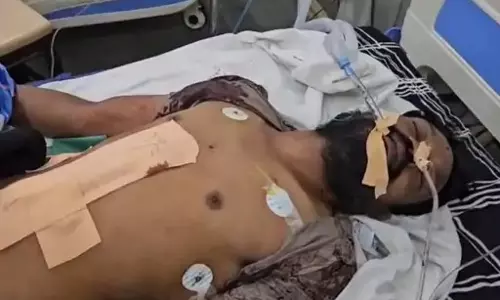 पत्नी से विवाद होने पर सुसाइड की कोशिश, चाकू खुद पर चलाया युवक ने