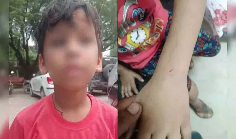 Up: अपने आँगन में अमरूद के लिए एक व्यक्ति ने कुत्ते को बच्चे पर हमला करने के लिए उकसाया Up: अपने आँगन में अमरूद के लिए एक व्यक्ति ने कुत्ते को बच्चे पर हमला करने के लिए उकसाया