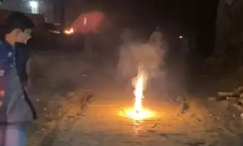 21 लोग पटाखे से घायल, दुर्ग जिला अस्पताल में भर्ती 21 लोग पटाखे से घायल, दुर्ग जिला अस्पताल में भर्ती