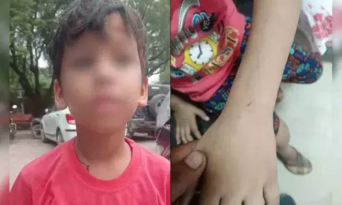 Up: अपने आँगन में अमरूद के लिए एक व्यक्ति ने कुत्ते को बच्चे पर हमला करने के लिए उकसाया Up: अपने आँगन में अमरूद के लिए एक व्यक्ति ने कुत्ते को बच्चे पर हमला करने के लिए उकसाया