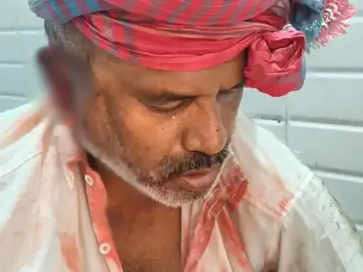 कबाड़ी के साथ लूटपाट, लहूलुहान कर कैश और मोबाइल लूट ले गए बदमाश कबाड़ी के साथ लूटपाट, लहूलुहान कर कैश और मोबाइल लूट ले गए बदमाश