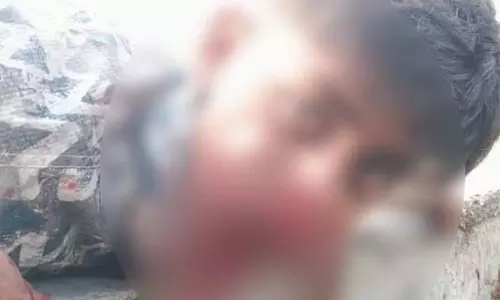 जानबूझकर अपने मुंह में सुतली बम रखकर फोड़ा, हुआ ये हाल