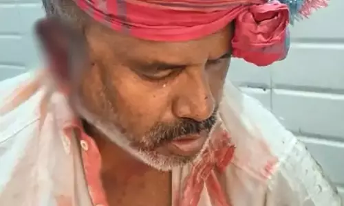 कबाड़ी के साथ लूटपाट, लहूलुहान कर कैश और मोबाइल लूट ले गए बदमाश