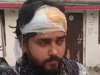 उपद्रवी ने की हत्या की कोशिश, हथौड़ी से युवक को मारा उपद्रवी ने की हत्या की कोशिश, हथौड़ी से युवक को मारा