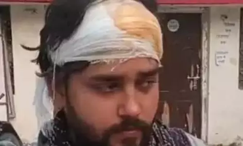 उपद्रवी ने की हत्या की कोशिश, हथौड़ी से युवक को मारा उपद्रवी ने की हत्या की कोशिश, हथौड़ी से युवक को मारा