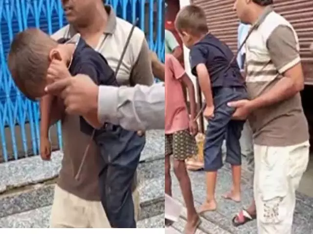 मासूम छत से गिरा, सरिया पेट में फंसी, हालत नाजुक मासूम छत से गिरा, सरिया पेट में फंसी, हालत नाजुक