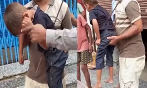 मासूम छत से गिरा, सरिया पेट में फंसी, हालत नाजुक मासूम छत से गिरा, सरिया पेट में फंसी, हालत नाजुक