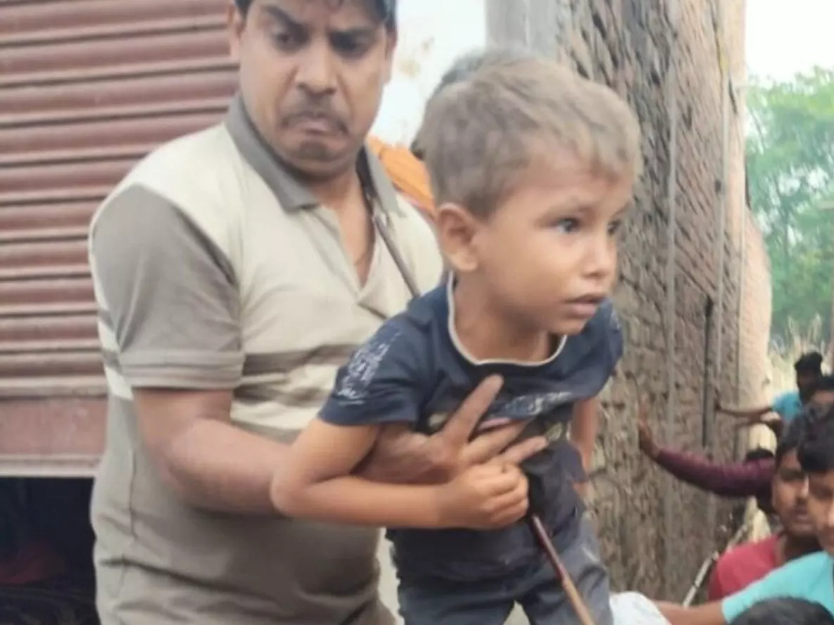 Fatehpur: खेलते समय बड़ा हादसा, 5 साल के बच्चे के पेट में आर-पार हुआ सरिया Fatehpur: खेलते समय बड़ा हादसा, 5 साल के बच्चे के पेट में आर-पार हुआ सरिया