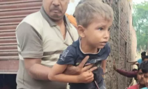 Fatehpur: खेलते समय बड़ा हादसा, 5 साल के बच्चे के पेट में आर-पार हुआ सरिया