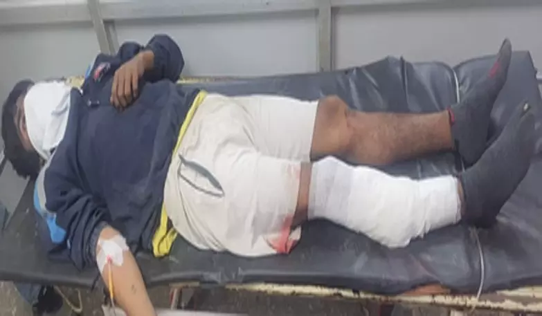पुलिस और बदमाश के बीच मुठभेड़, आरोपी गिरफ्तार पुलिस और बदमाश के बीच मुठभेड़, आरोपी गिरफ्तार