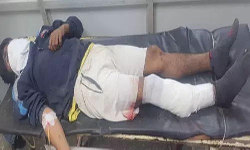पुलिस और बदमाश के बीच मुठभेड़, आरोपी गिरफ्तार
