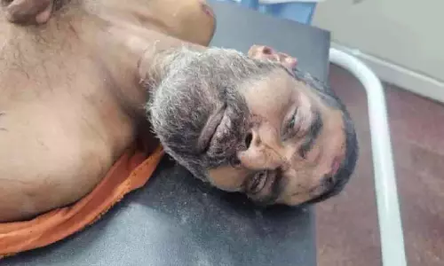 Kerala : अलप्पुझा का रहने वाला कोडुंगल्लूर में गंभीर चोटों के साथ मिला Kerala : अलप्पुझा का रहने वाला कोडुंगल्लूर में गंभीर चोटों के साथ मिला