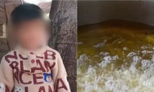 MP: बागेश्वर धाम में सांडों ने खौलते तेल से मचाई दहशत, बच्चा झुलसा, विक्रेता घायल