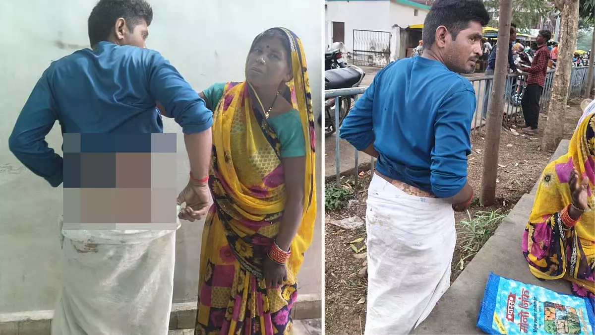 युवक को कूड़ेदान तक घसीटा गया, आग लगा दी गई; मां ने आग बुझाई और उसे अस्पताल पहुंचाया युवक को कूड़ेदान तक घसीटा गया, आग लगा दी गई; मां ने आग बुझाई और उसे अस्पताल पहुंचाया