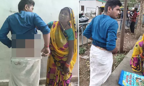 युवक को कूड़ेदान तक घसीटा गया, आग लगा दी गई; मां ने आग बुझाई और उसे अस्पताल पहुंचाया
