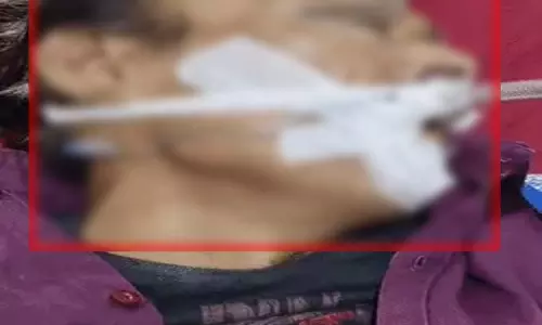 अस्पताल में मोतियाबिंद ऑपरेशन से पहले मरीज की मौत, परिजन सदमें में अस्पताल में मोतियाबिंद ऑपरेशन से पहले मरीज की मौत, परिजन सदमें में