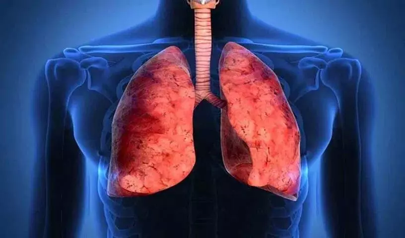 क्या आपको asthma है.. तो अपनाएं ये टिप्स.. मिलेगी राहत..! क्या आपको asthma है.. तो अपनाएं ये टिप्स.. मिलेगी राहत..!