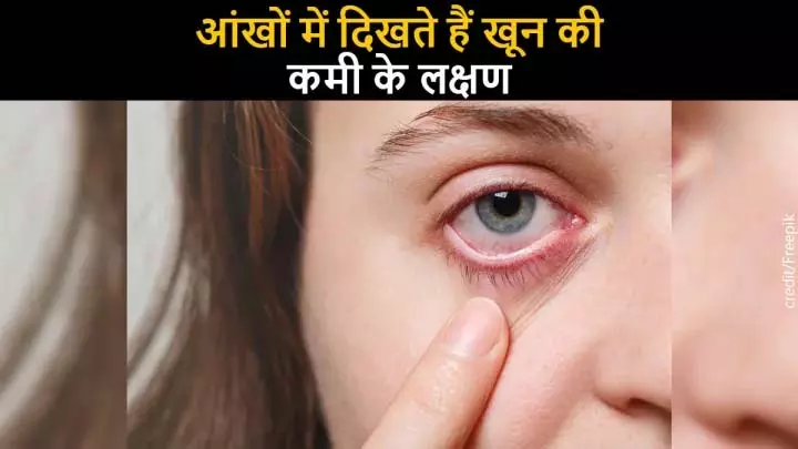 शरीर में Blood की कमी: आंखों में दिखाई देने वाले लक्षण और समाधान शरीर में Blood की कमी: आंखों में दिखाई देने वाले लक्षण और समाधान