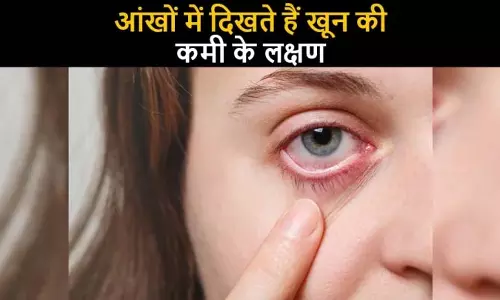 शरीर में Blood की कमी: आंखों में दिखाई देने वाले लक्षण और समाधान शरीर में Blood की कमी: आंखों में दिखाई देने वाले लक्षण और समाधान