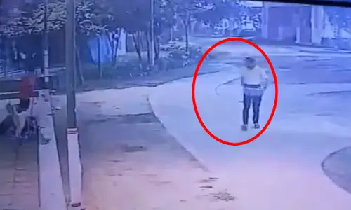 आवारा कुत्तों का आतंक फिर बढ़ा, सोसायटी में रेजिडेंट पर हमला, LIVE वीडियो