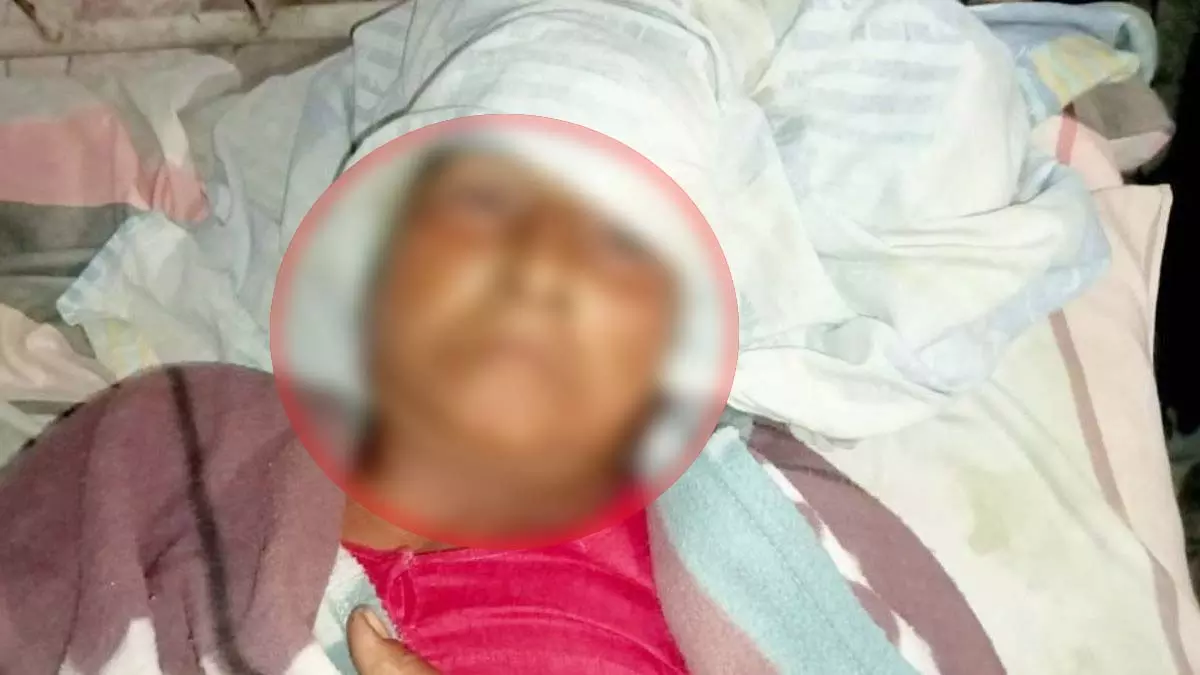 रिश्ते से इंकार करने पर युवती की मां पर लोहे के हथौड़े से हमला, आरोपी दीपक अग्रवाल फरार रिश्ते से इंकार करने पर युवती की मां पर लोहे के हथौड़े से हमला, आरोपी दीपक अग्रवाल फरार