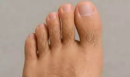 Hair On Toe: स्त्रियों के पैरों के अंगूठे पर बाल होना शुभ है या अशुभ Hair On Toe: स्त्रियों के पैरों के अंगूठे पर बाल होना शुभ है या अशुभ