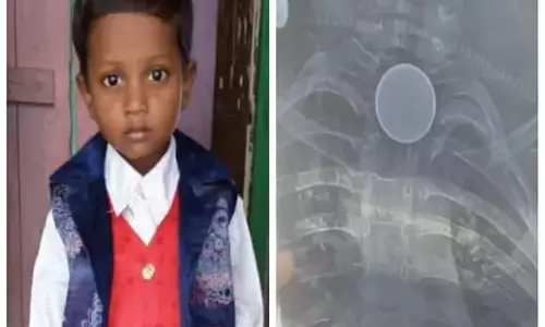 सिक्के को निगल गया मासूम, मौत सिक्के को निगल गया मासूम, मौत