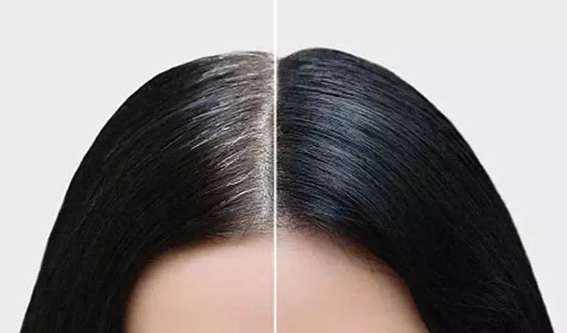 अपने सफेद बालों को सबसे प्राकृतिक तरीके से काला करें.. इन सुझावों का पालन करें..! अपने सफेद बालों को सबसे प्राकृतिक तरीके से काला करें.. इन सुझावों का पालन करें..!