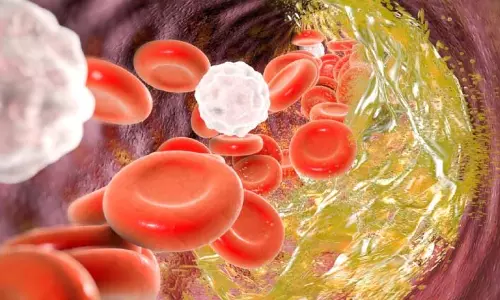 Health: कोलेस्ट्रॉल बढ़ने के ये 5 लक्षण पहचानें, अनजाने में न करें नजरअंदाज