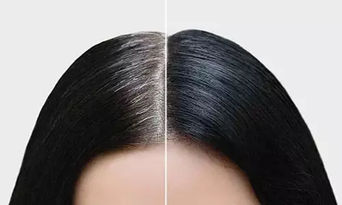 अपने सफेद बालों को सबसे प्राकृतिक तरीके से काला करें.. इन सुझावों का पालन करें..! अपने सफेद बालों को सबसे प्राकृतिक तरीके से काला करें.. इन सुझावों का पालन करें..!