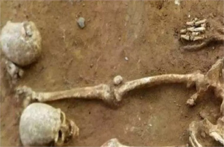 Uttarakhand: 21 वर्षीय लापता युवक का कंकाल बरामद Uttarakhand: 21 वर्षीय लापता युवक का कंकाल बरामद