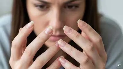 भंगुर नाखून: सिर्फ़ दिखावट नहीं, Health का संकेत भंगुर नाखून: सिर्फ़ दिखावट नहीं, Health का संकेत