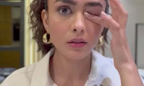 Mrunal Thakur ने आंखों के मेकअप के बाद की मजेदार परेशानियों को दिखाया