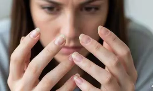 भंगुर नाखून: सिर्फ़ दिखावट नहीं, Health का संकेत