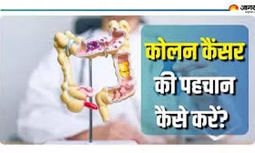 30 की उम्र से पहले भी हो सकता है Colon cancer,  पहचानें ये 5 साइलेंट लक्षण