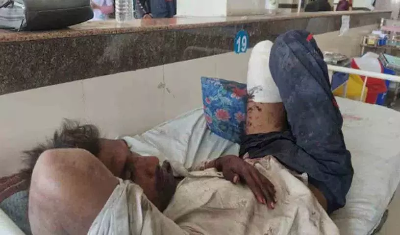 Ujjain में डकैती में एक व्यक्ति का पैर कटा, पुलिस ने छोड़ा अंग Ujjain में डकैती में एक व्यक्ति का पैर कटा, पुलिस ने छोड़ा अंग