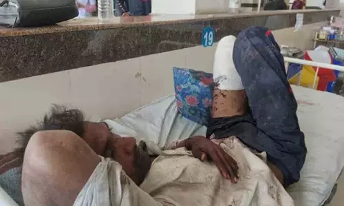 Ujjain में डकैती में एक व्यक्ति का पैर कटा, पुलिस ने छोड़ा अंग Ujjain में डकैती में एक व्यक्ति का पैर कटा, पुलिस ने छोड़ा अंग