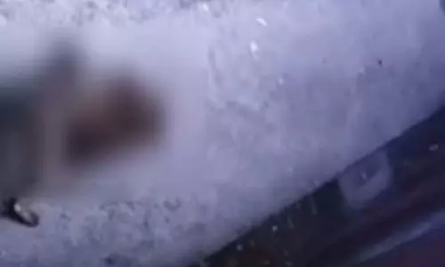 Thane : 2 साल की बच्ची पर आवारा कुत्ते ने हमला किया